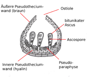 Fig: Pseudothecium