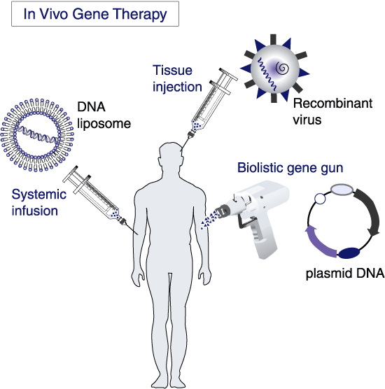 in-vivo gene therapy